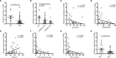 Tofacitinib Ameliorates Lupus Through Suppression of T Cell Activation Mediated by TGF-Beta Type I Receptor